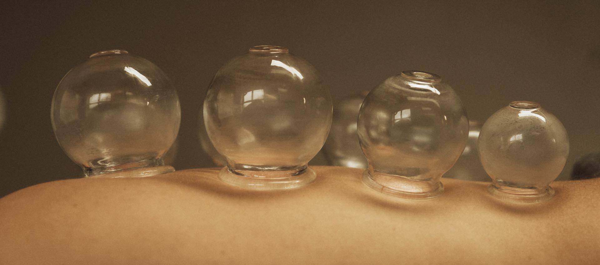 Acupunctuurpraktijk De Haere in Doornspijk Cuppen {{brizy_dc_image_alt imageSrc=