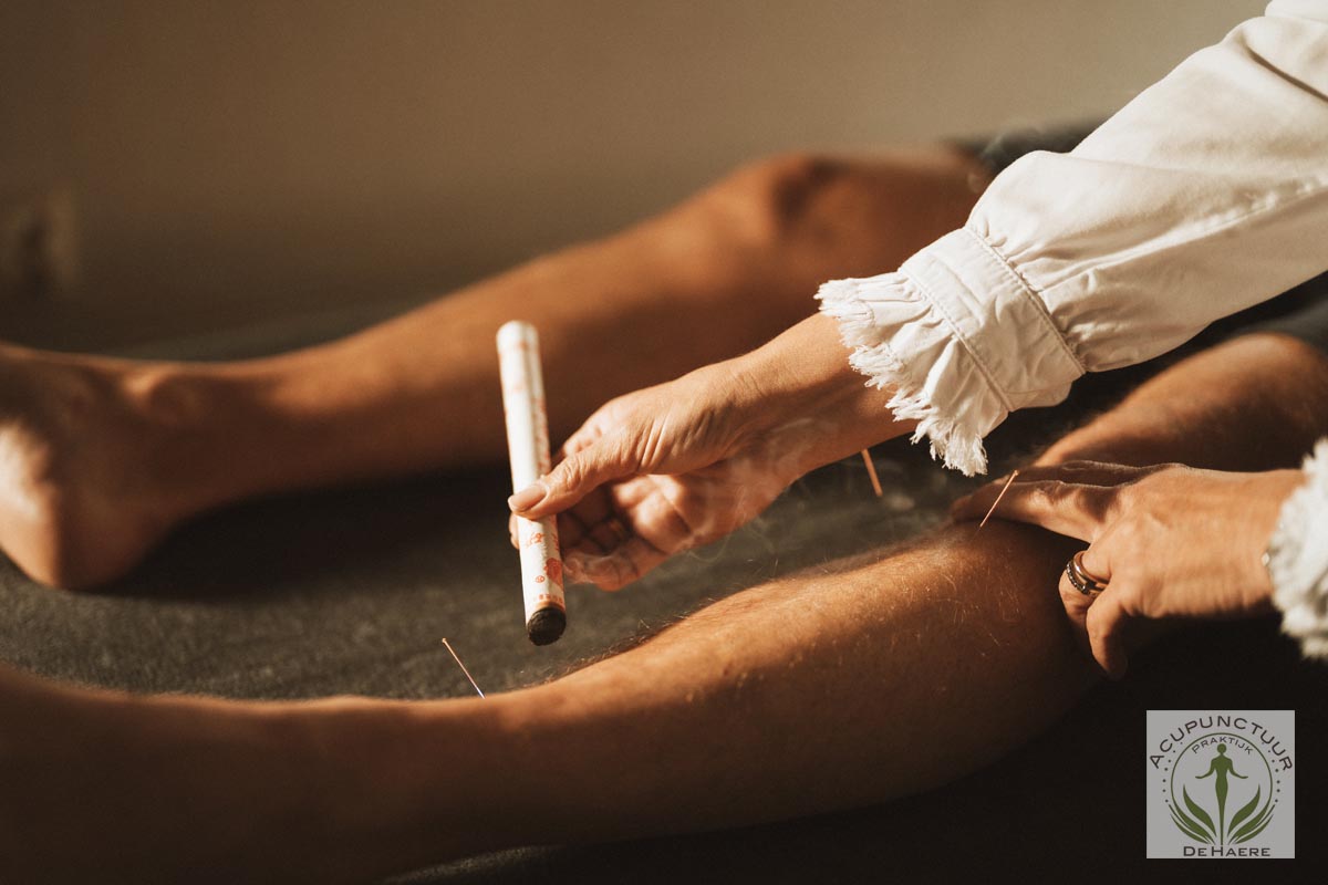 Moxa therapie behandeling acupunctuurpraktijk De Haere in Doornspijk {{brizy_dc_image_alt imageSrc=